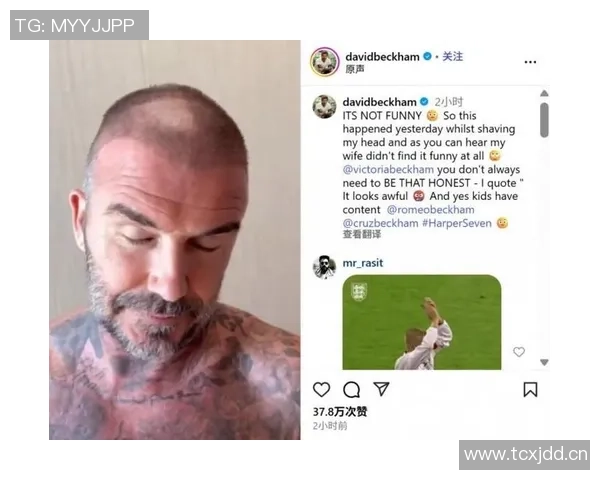 奥斯梅恩国家队比赛受伤将返回加拉塔萨雷进行详细检查